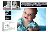 Ушные корректоры маирс от лопоухости на 4шт. для детей и новорожденных
