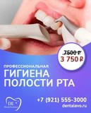 Профессиональная гигиена полости рта и зубов (комплексная) Акция